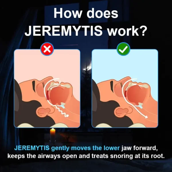 JEREMYTIS™ Adjustable Anti-Snoring Mouthpiece