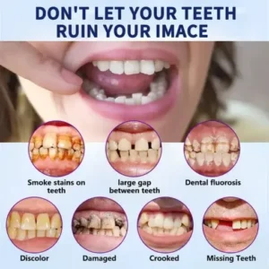 NESLEMY™- Advanced Customized Full Denture Set
