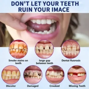 AEXZR™ Advanced Full Denture Set