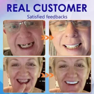 AEXZR™ Advanced Full Denture Set