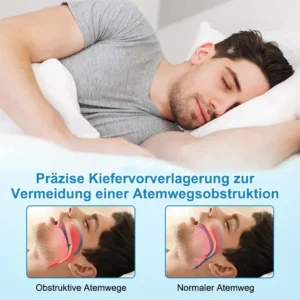 ✨JEREMYTIS™ Anti-Schnarch- und Anti-Schleif-Zahnschutz