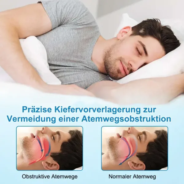 ✨JEREMYTIS™ Anti-Schnarch- und Anti-Schleif-Zahnschutz