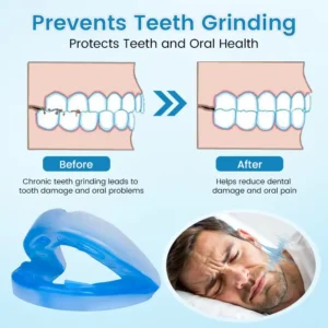 JEREMYTIS™ Anti-Snoring & Anti-Grinding Teeth Protector
