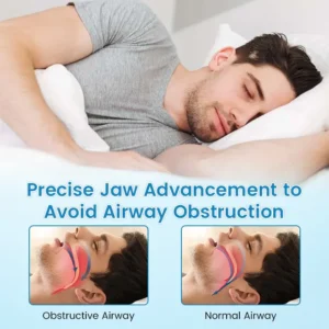 JEREMYTIS™ Anti-Snoring & Anti-Grinding Teeth Protector