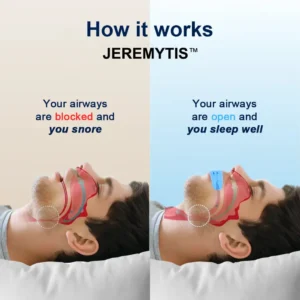 JEREMYTIS™  Professional intelligent anti-snoring device