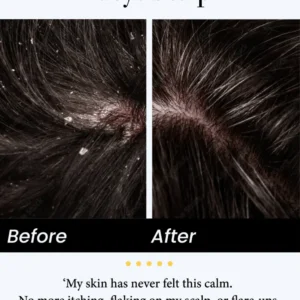 🔥Last Day -49% off🔥JEREMYTIS™ Natural Calming Serum✨